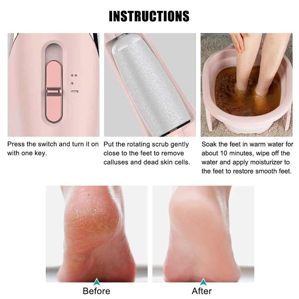 FootEase Rechargeable Pedi Kit