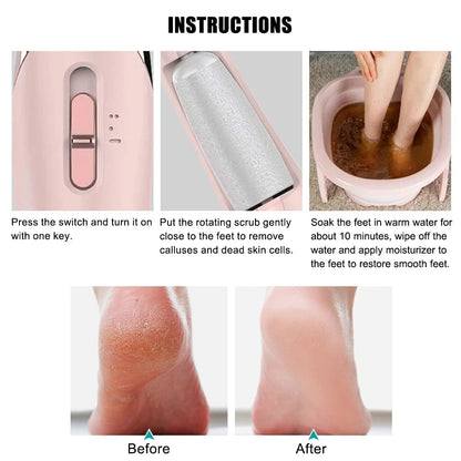 FootEase Rechargeable Pedi Kit